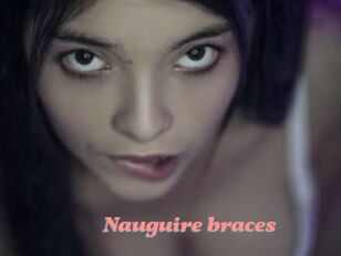 Nauguire_braces